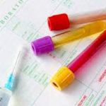 free SMA blood test